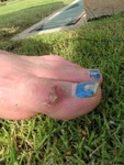YAMJTP (Yet Another Mangled Jason Toe Picture)